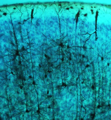neuraltherapie